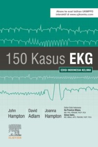 150 kasus EKG